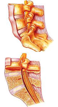 腰椎の構造